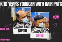 Hair Patch
