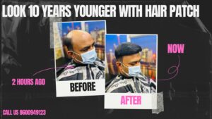 Hair Patch