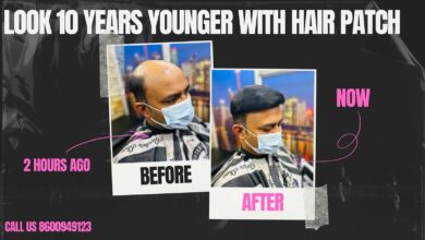 Hair Patch