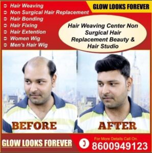 Hair Patch