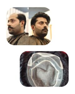 Hair Patch