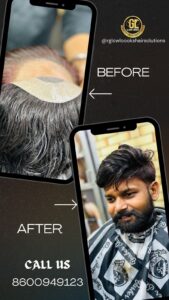 Hair Patch