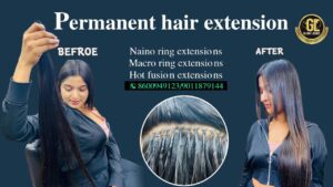Hair Patches
